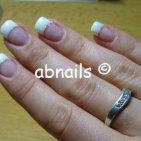 Abnails